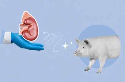 Pigs Could End the Transplant Waiting List